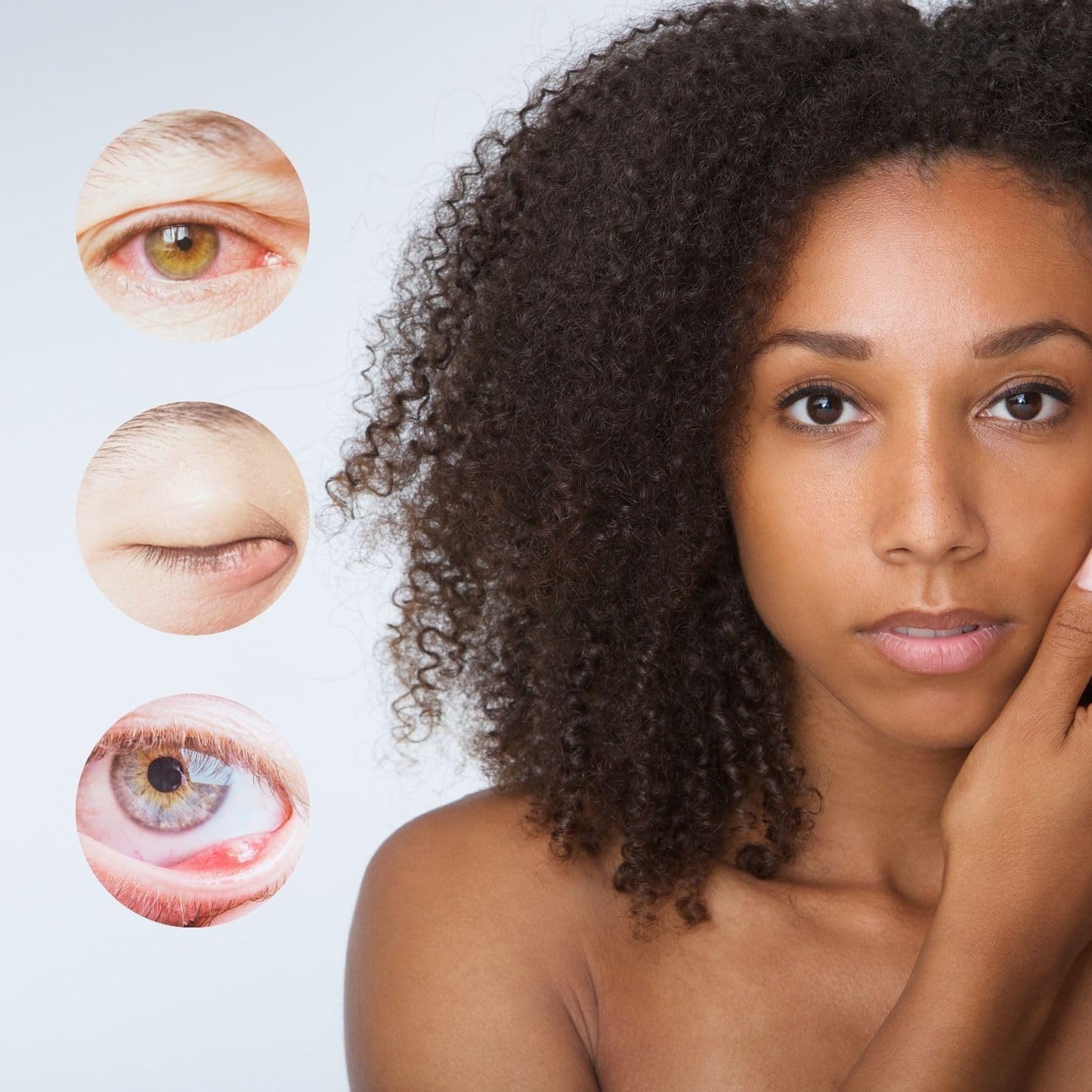 StyeRx Stye Relief Formula